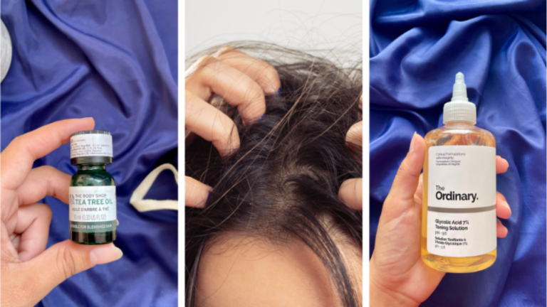 How to Get Rid of Itchy Scalp Before You Literally Lose Your Mind (and your edges) 2026