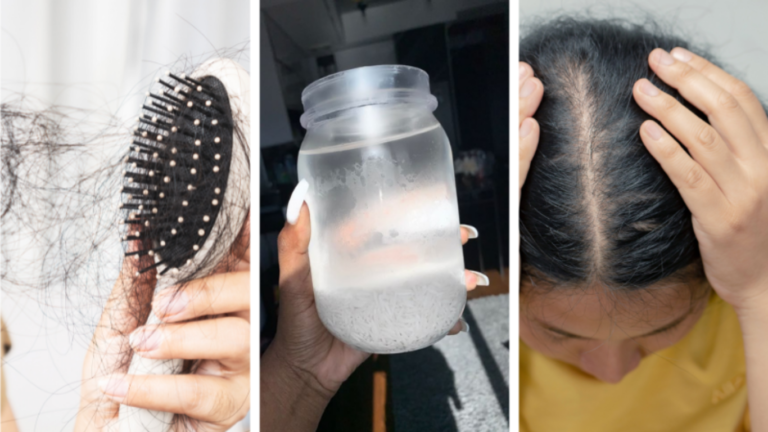 Hair Everywhere But Your Head? These 9 Home Remedies for Hairfall Are Lifesavers 2026